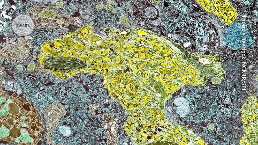 Related image for Alzheimer’s Disease