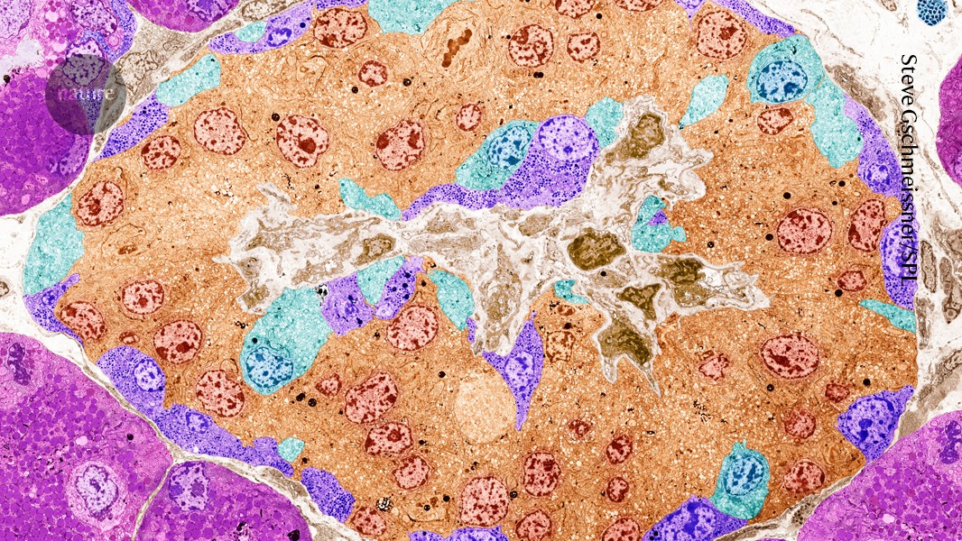 Related image for CRISPR Diabetes
