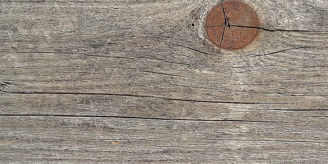 How Federated Learning Works in Healthcare – seizure detection