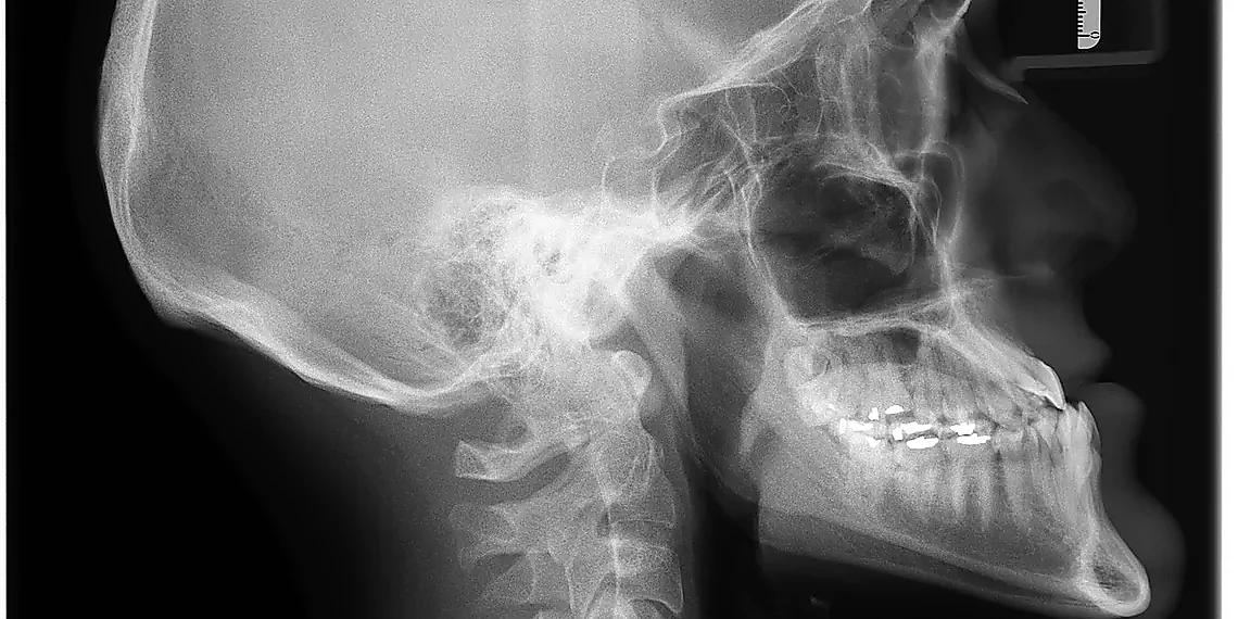 Decoding the Colors: Infrared & X-ray Fusion – JWST galaxy collision