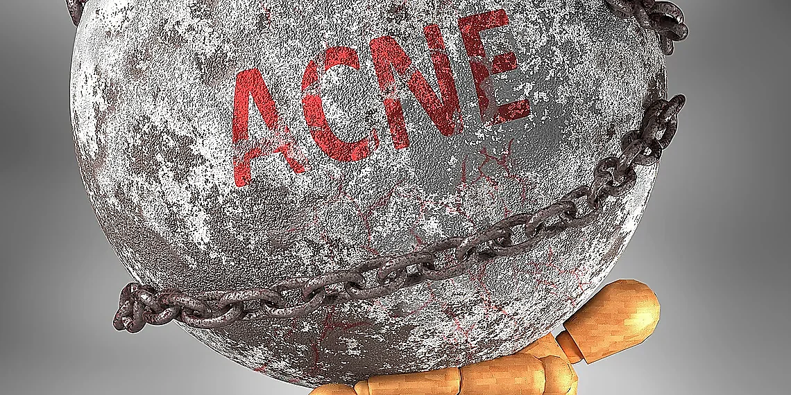 Beyond Recurrence: The Bottleneck Problem – attention mechanisms